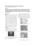 Mucoepidermoid Carcinoma of Lower Lip