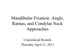 Mandibular Fixation: Angle, Ramus, and Condylar Neck Fractures