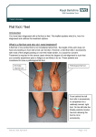 Flat foot / feet - Royal Berkshire Hospital