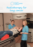 Radiotherapy for lung cancer - Roy Castle Lung Cancer Foundation