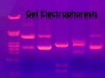 Gel Electrophoresis