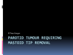 Parotid tumour requiring mastoid tip removal