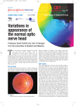 Variations in appearance of the normal optic nerve head