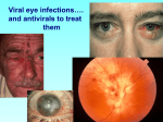 Herpes and Other Viral Diseases of the Eye