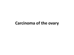 Carcinoma of the ovary