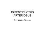 Patent Ductus Arteriosis - Nicole Stevens