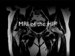 MRI of the HIP