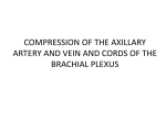 compression of the axillary artery and vein and