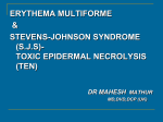 erythema multiforme - Dr. Raj Kumar Sharma