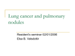 Lung cancer and pulmonary nodules - Dartmouth