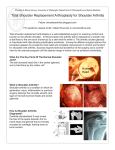 total shoulder replacement arthroplasty.