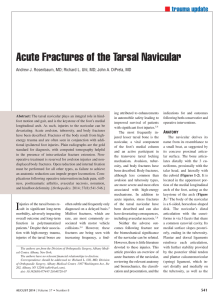 Acute Fractures of the Tarsal Navicular