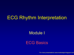 ECG Rhythm