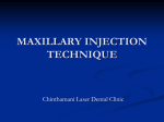 maxillary injection technique