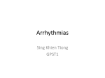 Arrhythmias 2