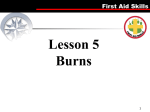 Burns - My Classes