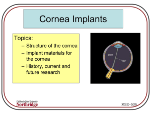 Cornea Implants