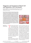 Diagnosis and Treatment of Basal Cell and Squamous Cell