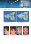 Schematic Lateral View Clinical Examples