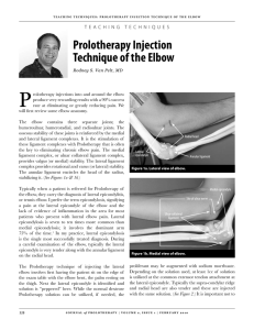 Prolotherapy Injection Technique of the Elbow
