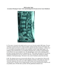 MRI Lumbar Spine Extradural Meningeal Tumor with