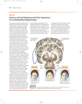 Facial Weakness diagram from Neuroscience 3rd