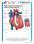 Right Ventricle to Pulmonary Artery (RV-PA