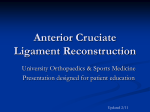 Anterior Cruciate Ligament Reconstruction