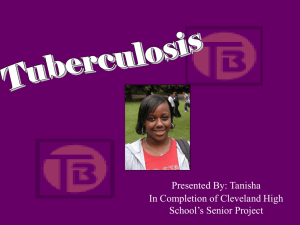 Tuberculosis