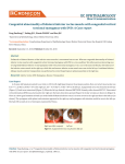 Congenital abnormality of bilateral inferior rectus