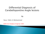 Differential Diagnosis of Cerebellopontine Angle - cox
