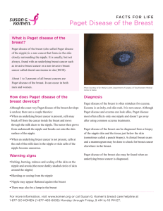 Paget Disease of the Breast