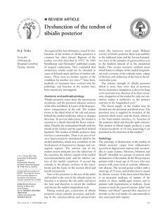 Dysfunction of the tendon of tibialis posterior