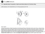 Adjustable Nasal Transposition of Split Lateral Rectus Muscle for