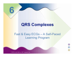 QRS Complexes (Fast and Easy ECGs, Shade / Wesley)