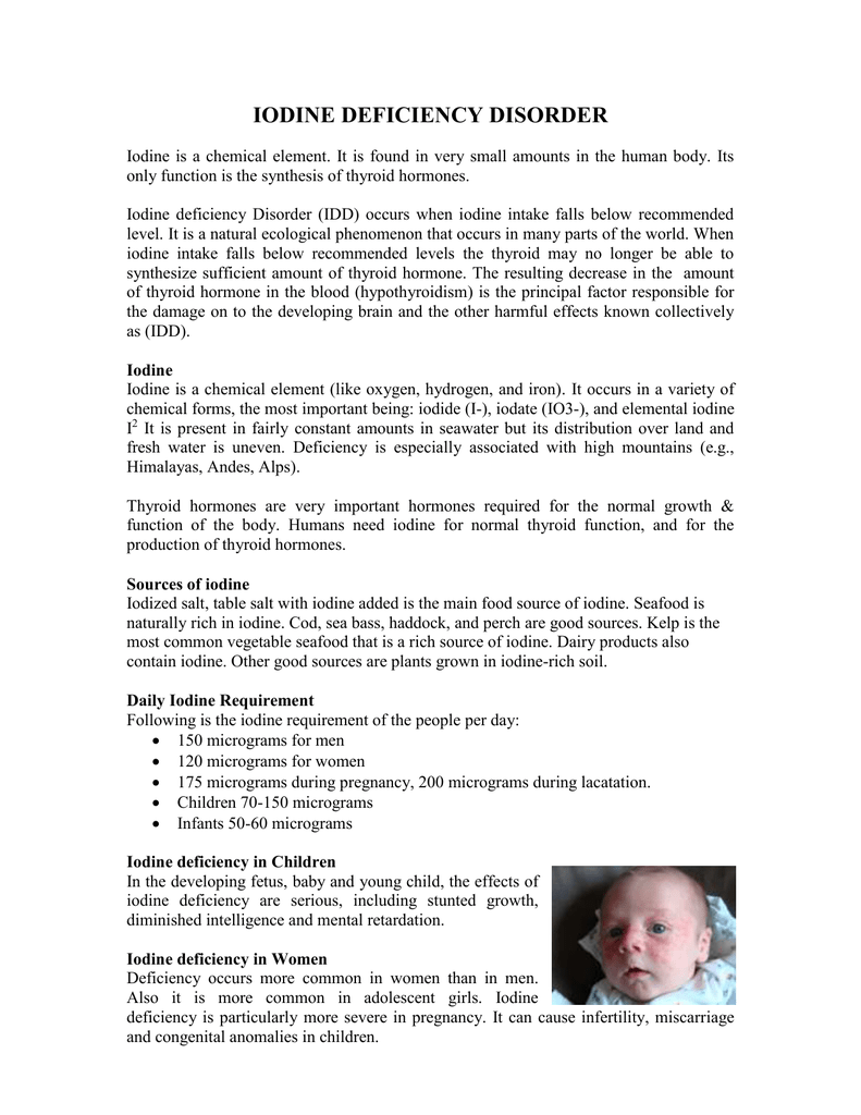 iodine deficiency disorders
