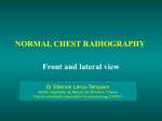 NORMAL CHEST RADIOGRAPHY Front and lateral view