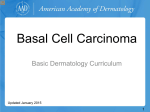 Basal Cell Carcinoma - American Academy of Dermatology