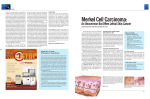 Merkel Cell Carcinoma: An Uncommon But Often Lethal Skin Cancer