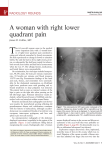 A woman with right lower quadrant pain