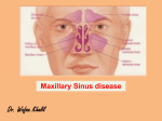 Maxillary Sinus