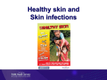 Serious skin infections