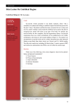 Skin Lesion On Umbilical Region