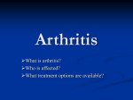 Arthritis -