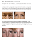 What is an Eyelid-Lift: Ptosis Repair or