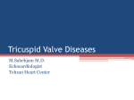 Tricuspid Valve Diseases