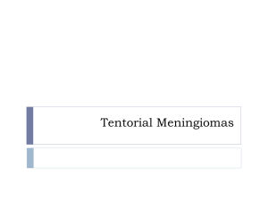 Tentorial Meningiomas
