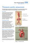 Thoracic aortic aneurysm - Guy`s and St Thomas` NHS Foundation