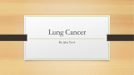 Lung Cancer - Jacob Tyvol