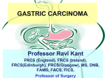 Gastric Carcinoma